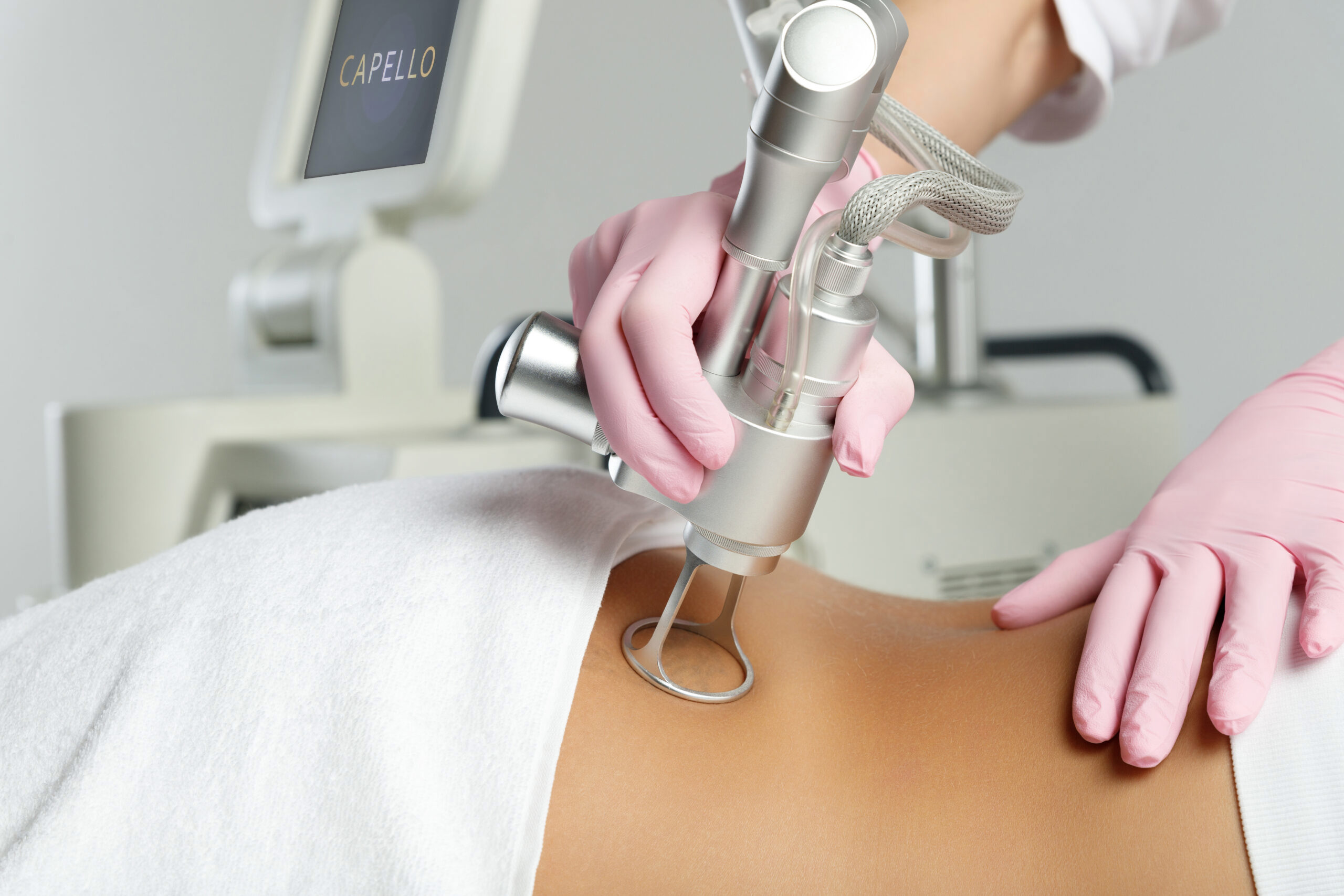 картинка Лазер Capello CO2  от магазина ЭпилСити